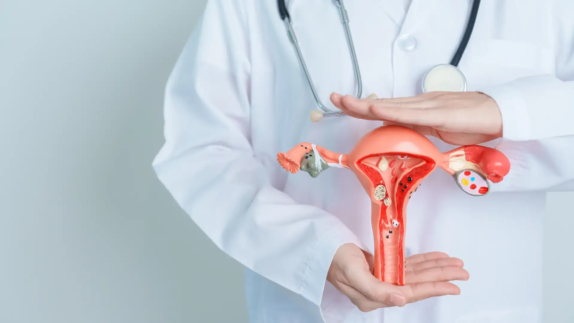 Treatment Options for Prolapse Post-Hysterectomy